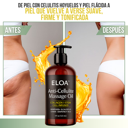 Eloa™ | Drenaje Linfático Anticelulitis