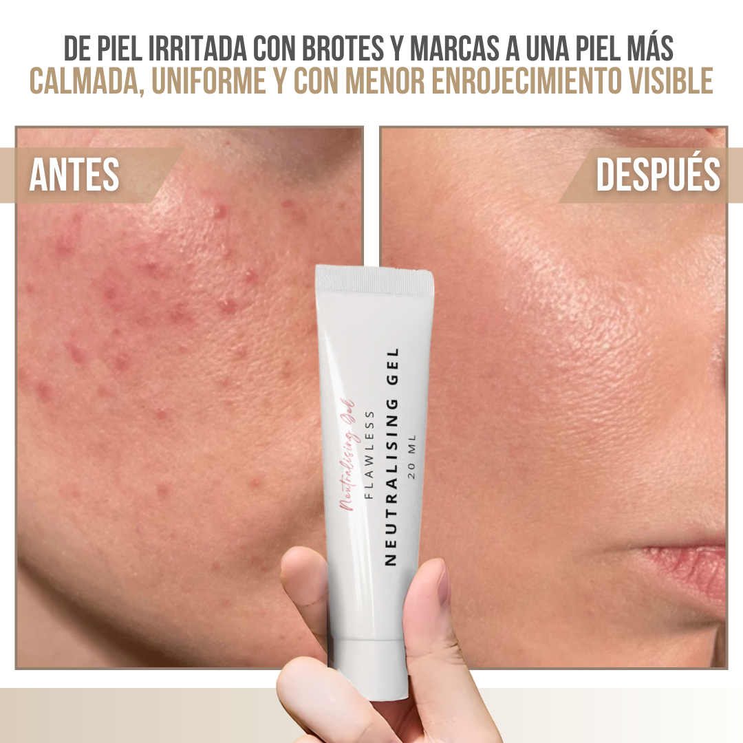 Neutralising Gel™ — Controla los brotes hoy, cuida tu piel a largo plazo